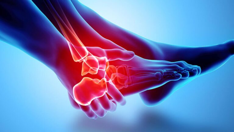 ankle pain diagram