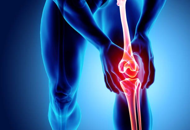 knee pain diagram