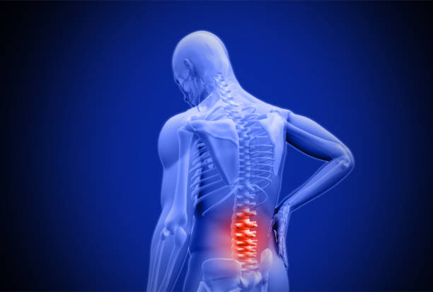 lower back pain diagram
