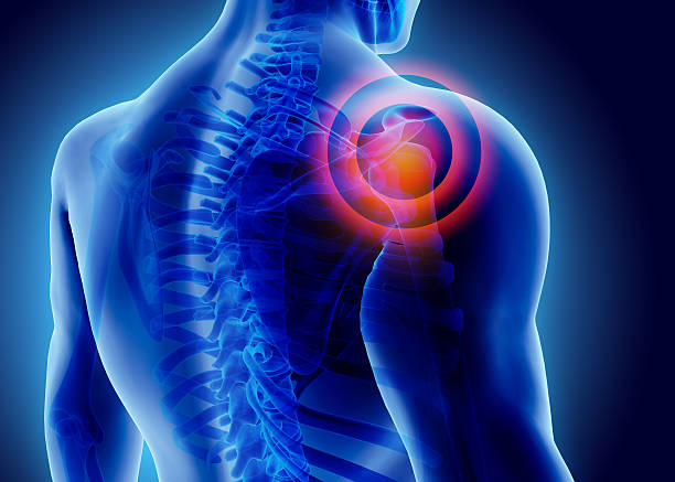 shoulder pain diagram